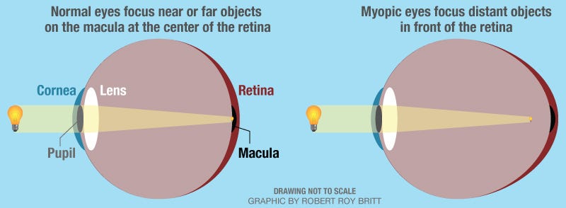 The impact of lifestyle on eye health