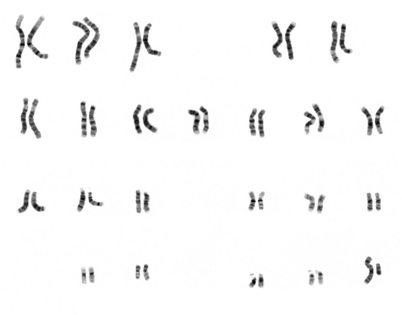 Giemsa stained human male karyotype