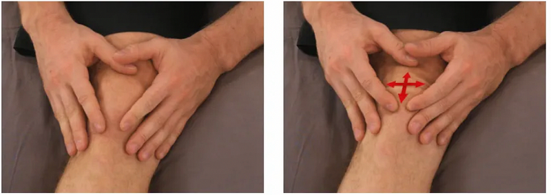 Patellar mobilization exercise